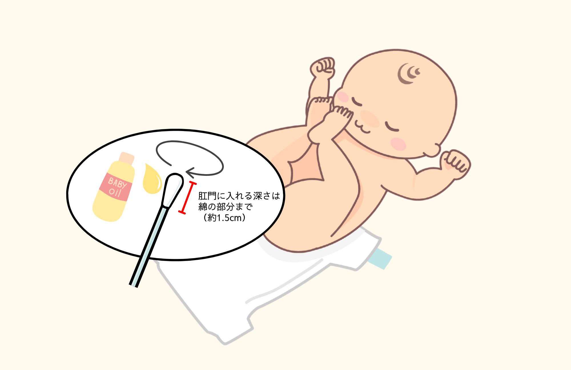 赤ちゃんの肛門に綿棒を入れて刺激しているイラスト